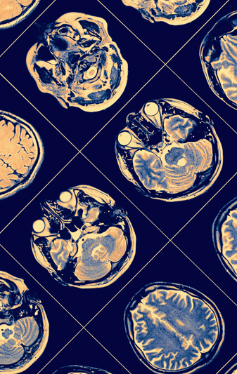 Give you access to vital resources if you have a data breach